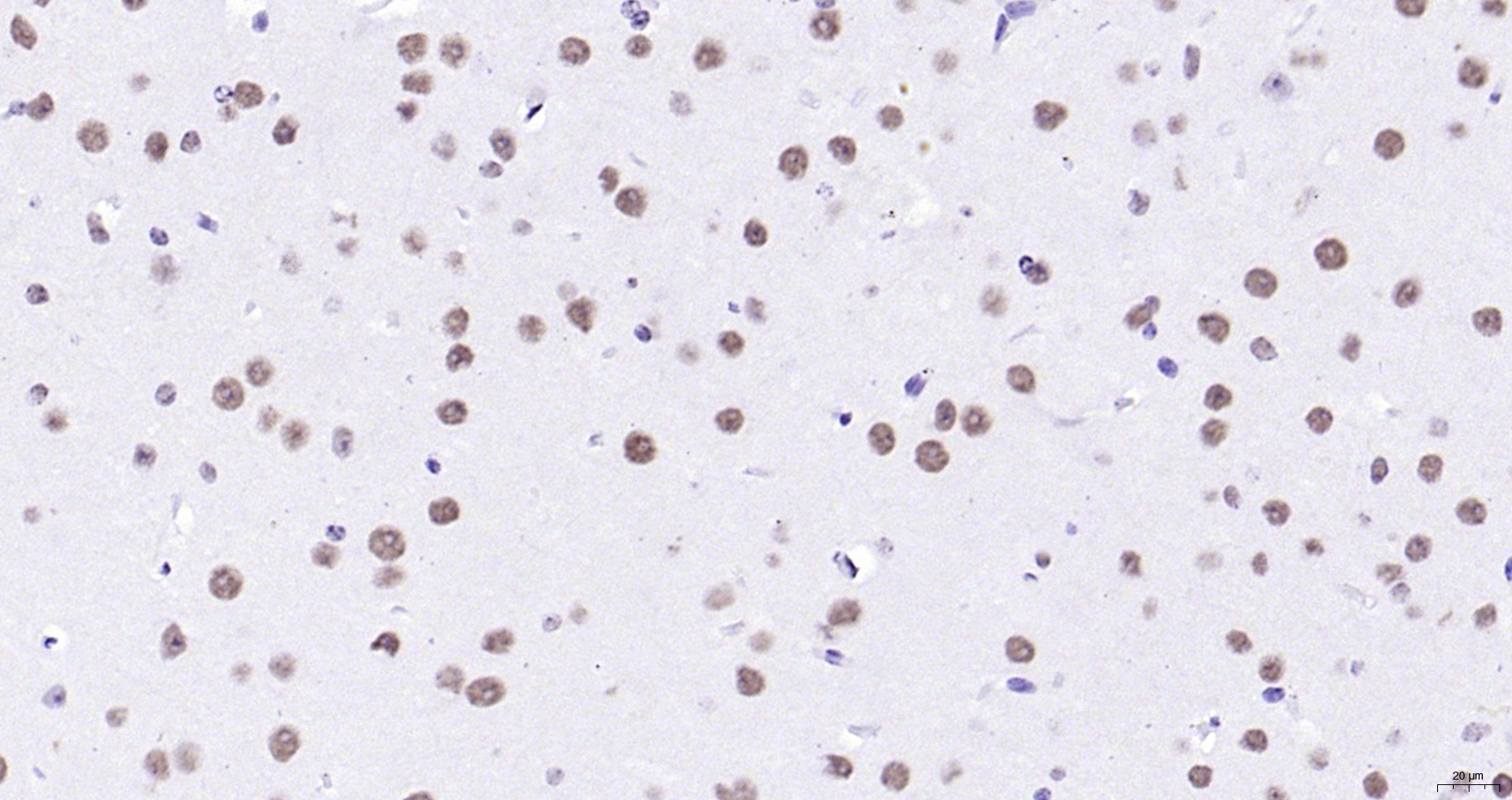 Paraformaldehyde-fixed, paraffin embedded (mouse brain); Antigen retrieval by boiling in sodium citrate buffer (pH6.0) for 15min; Block endogenous peroxidase by 3% hydrogen peroxide for 20 minutes; Blocking buffer (normal goat serum) at 37°C for 30min; Antibody incubation with (KLHL7) Polyclonal Antibody, Unconjugated (bs-5935R) at 1:200 overnight at 4°C, followed by operating according to SP Kit(Rabbit) (sp-0023) instructionsand DAB staining.
