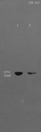 L1 Mouse liver lysates, L2 Mouse cerebrum lysates probed with Anti- EDG2/LPA1 Polyclonal Antibody, Unconjugated (bs-2880R) at 1:300 in 4˚C. Followed by conjugation to secondary antibody (bs-0295G-HRP) at 1:2000 90min in 37˚C. Predicted band and observed band size: 41kD