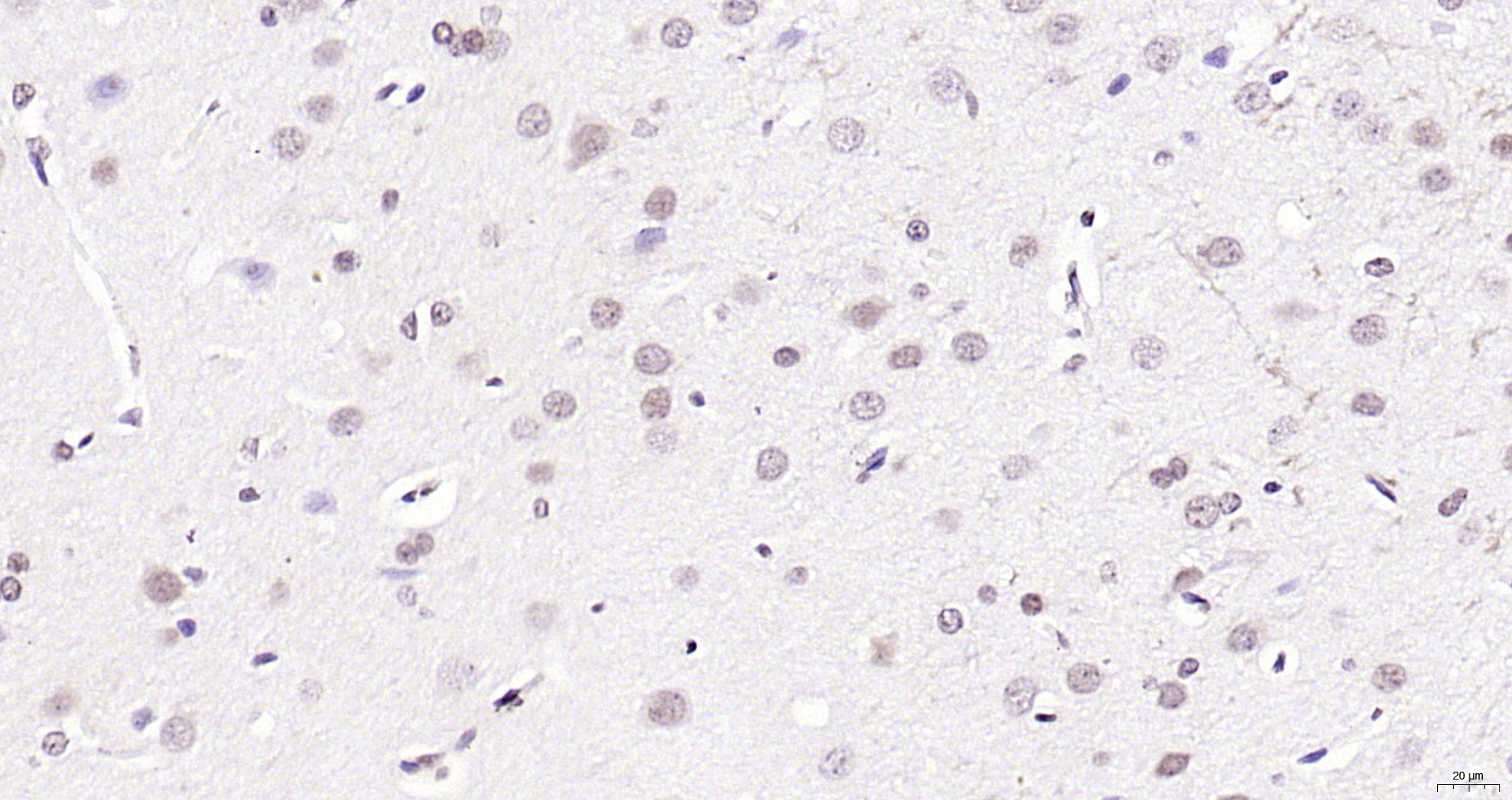 Paraformaldehyde-fixed, paraffin embedded (rat brain); Antigen retrieval by boiling in sodium citrate buffer (pH6.0) for 15min; Block endogenous peroxidase by 3% hydrogen peroxide for 20 minutes; Blocking buffer (normal goat serum) at 37°C for 30min; Antibody incubation with (CIDEC) Polyclonal Antibody, Unconjugated (bs-6796R) at 1:200 overnight at 4°C, followed by operating according to SP Kit(Rabbit) (sp-0023) instructionsand DAB staining.