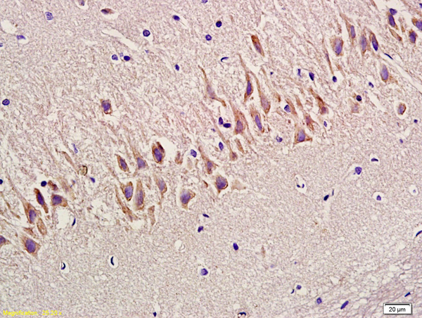 Formalin-fixed and paraffin embedded rat hippocampus labeled with Anti-SYN1\/Synapsin 1 Polyclonal Antibody, Unconjugated (bs-3501R) at 1:300 followed by conjugation to the secondary antibody and DAB staining
