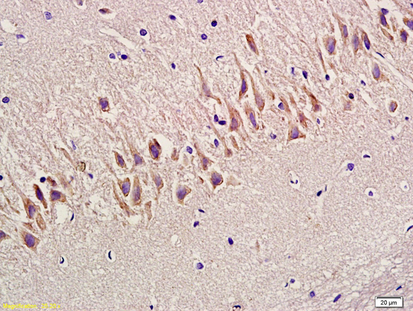 Formalin-fixed and paraffin embedded rat hippocampus labeled with Anti-SYN1/Synapsin 1 Polyclonal Antibody, Unconjugated (bs-3501R) at 1:300 followed by conjugation to the secondary antibody and DAB staining