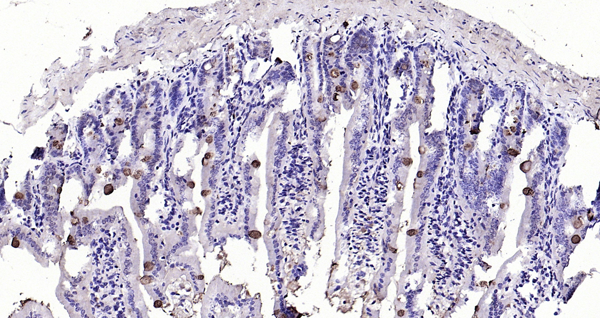 Paraformaldehyde-fixed, paraffin embedded (Mouse small intestine); Antigen retrieval by boiling in sodium citrate buffer (pH6.0) for 15min; Block endogenous peroxidase by 3% hydrogen peroxide for 20 minutes; Blocking buffer (normal goat serum) at 37°C for 30min; Antibody incubation with (TFF3) Polyclonal Antibody, Unconjugated (bs-0535R) at 1:200 overnight at 4°C, followed by operating according to SP Kit(Rabbit) (sp-0023) instructionsand DAB staining.