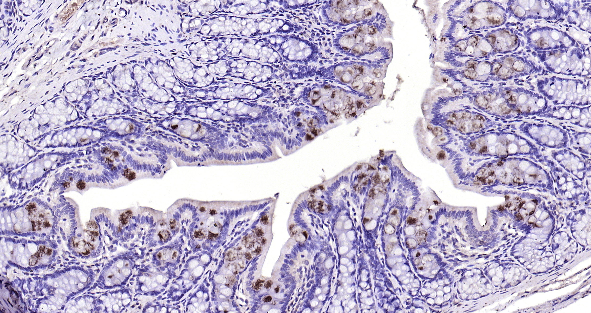 Paraformaldehyde-fixed, paraffin embedded (mouse colon); Antigen retrieval by boiling in sodium citrate buffer (pH6.0) for 15min; Block endogenous peroxidase by 3% hydrogen peroxide for 20 minutes; Blocking buffer (normal goat serum) at 37°C for 30min; Antibody incubation with (TFF3) Polyclonal Antibody, Unconjugated (bs-0535R) at 1:200 overnight at 4°C, followed by operating according to SP Kit(Rabbit) (sp-0023) instructionsand DAB staining.
