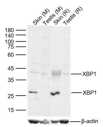 Lane 1: Mouse Skin Lysates; Lane 2: Mouse Testis Lysates; Lane 3: Rat Skin Lysates; Lane 4: Rat Testis Lysates. Probed with XBP1 polyclonal Antibody, unconjugated (bs-1668R) at 1:1000 dilution and 4°C overnight incubation. Followed by conjugated secondary antibody incubation at 1:20000 for 60 min at 37˚C.