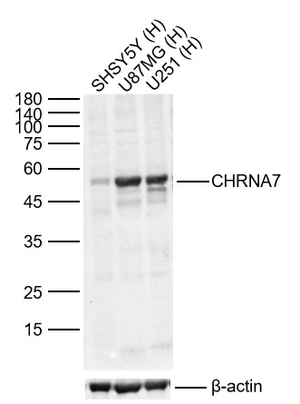 Lane 1: Human SH-SY5Y cell Lysates; Lane 2: Human U-87 MG cell Lysates; Lane 3: Human U251 cell Lysates. Probed with CHRNA7 polyclonal Antibody, unconjugated (bs-1049R) at 1:1000 dilution and 4°C overnight incubation. Followed by conjugated secondary antibody incubation at 1:20000 for 60 min at 37˚C.