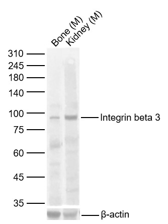 Lane 1: Mouse Bone Lysates; Lane 2: Mouse Kidney Lysates. Probed with Integrin beta 3polyclonal Antibody, unconjugated (bs-0342R) at 1:1000 dilution and 4°C overnight incubation. Followed by conjugated secondary antibody incubation at 1:20000 for 60 min at 37˚C.