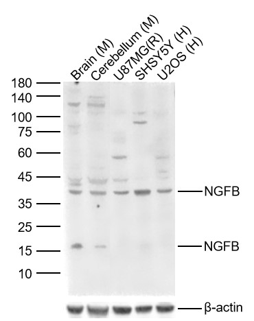 Lane 1: Mouse Brain Lysates; Lane 2: Mouse Cerebellum Lysates; Lane 3: Human U-87 MG cell Lysates; Lane 4: Human SH-SY5Y cell Lysates; Lane 5: Human U-2 OS cell Lysates. Probed with NGFB polyclonal Antibody, unconjugated (bs-10806R) at 1:1000 dilution and 4°C overnight incubation. Followed by conjugated secondary antibody incubation at 1:20000 for 60 min at 37˚C.