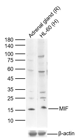 Lane 1: Rat Aldrenal gland Lysates; Lane 2: Human HL-60 cell Lysates. Probed with MIF polyclonal Antibody, unconjugated (bs-1044R) at 1:1000 dilution and 4°C overnight incubation. Followed by conjugated secondary antibody incubation at 1:20000 for 60 min at 37˚C.
