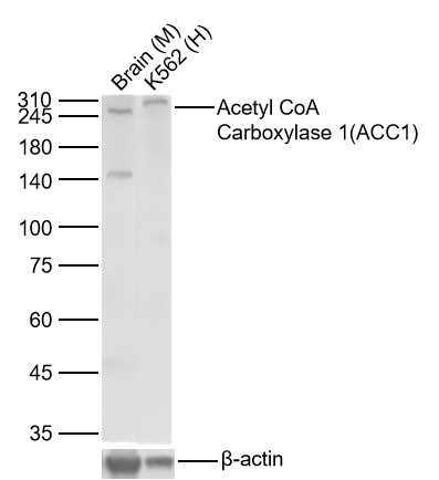 Lane 1: Mouse Brain Lysates; Lane 2: Human K562 cell Lysates. Probed with Acetyl CoA Carboxylase 1(ACC1) monoclonal Antibody, unconjugated (bsm-52486R) at 1:300 dilution and 4°C overnight incubation. Followed by conjugated secondary antibody incubation at 1:20000 for 60 min at 37˚C.