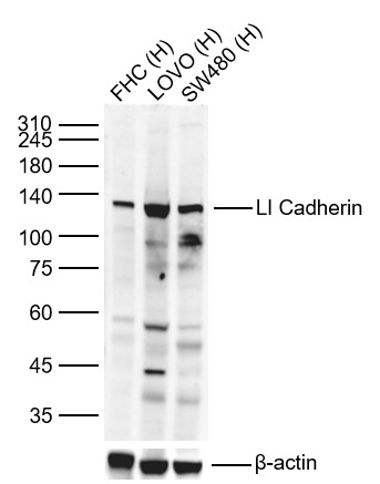 Lane 1: Human FHC cell Lysates; Lane 2: Human LOVO cell Lysates; Lane 3: Human SW480 cell Lysates. Probed with LI Cadherin polyclonal Antibody, unconjugated (bs-1617R) at 1:1000 dilution and 4°C overnight incubation. Followed by conjugated secondary antibody incubation at 1:20000 for 60 min at 37˚C.