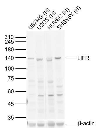 Lane 1: Human U-87 MG cell Lysates; Lane 2: Human U2OS cell Lysates; Lane 3: Human HUVEC cell Lysates; Lane 4: Human SH-SY5Y cell Lysates. Probed with LIFR polyclonal Antibody, unconjugated (bs-1458R) at 1:1000 dilution and 4°C overnight incubation. Followed by conjugated secondary antibody incubation at 1:20000 for 60 min at 37˚C. Lane 1: Human U-87 MG cell Lysates; Lane 2: Human U2OS cell Lysates; Lane 3: Human HUVEC cell Lysates; Lane 4: Human SH-SY5Y cell Lysates. Probed with LIFR polyclonal Antibody, unconjugated (bs-1458R) at 1:1000 dilution and 4°C overnight incubation. Followed by conjugated secondary antibody incubation at 1:20000 for 60 min at 37˚C.