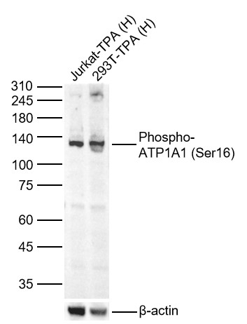 Lane 1: Human Jurkat-TPA cell Lysates; Lane 2: Human 293T-TPA cell Lysates. Probed with Phospho-ATP1A1 (Ser16) polyclonal Antibody, unconjugated (bs-3035R) at 1:1000 dilution and 4°C overnight incubation. Followed by conjugated secondary antibody incubation at 1:20000 for 60 min at 37˚C.