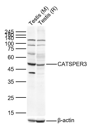 Lane 1: Mouse Testis Lysates; Lane 2: Rat Testis Lysates. Probed with CATSPER3 polyclonal Antibody, unconjugated (bs-7136R) at 1:1000 dilution and 4°C overnight incubation. Followed by conjugated secondary antibody incubation at 1:20000 for 60 min at 37˚C.
