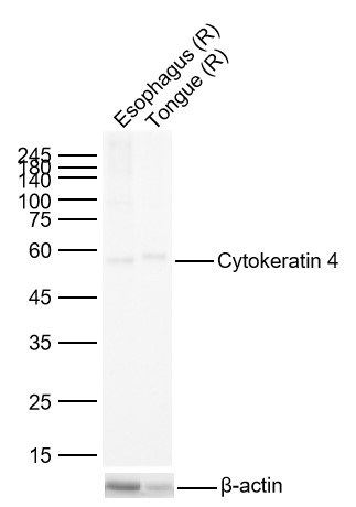 Lane 1: Rat Esophagus Lysates; Lane 2: Rat Tongue Lysates. Probed with Cytokeratin 4 monoclonal Antibody, unconjugated (bsm-52062R) at 1:1000 dilution and 4\u00b0C overnight incubation. Followed by conjugated secondary antibody incubation at 1:20000 for 60 min at 37˚C.