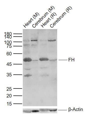 Lane 1: Mouse Heart tissue lysates; Lane 2: Mouse Cerebrum tissue lysates; Lane 3: Rat Heart tissue lysates; Lane 4: Rat Cerebrum tissue lysates probed with FH Polyclonal Antibody, Unconjugated (bs-3938R) at 1:1000 dilution and 4°C overnight incubation. Followed by conjugated secondary antibody incubation at 1:20000 for 60 min at 37˚C.