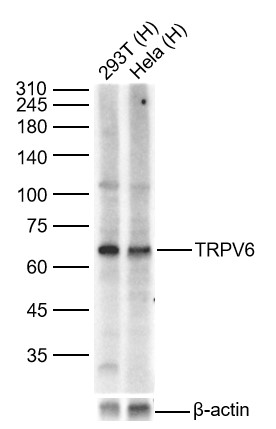 Lane 1: Human 293T cell Lysates; Lane 2: Human Hela cell Lysates. Probed with TRPV6 polyclonal Antibody, unconjugated (bs-15506R) at 1:500 dilution and 4°C overnight incubation. Followed by conjugated secondary antibody incubation at 1:20000 for 60 min at 37˚C. Lane 1: Human 293T cell Lysates; Lane 2: Human Hela cell Lysates. Probed with TRPV6 polyclonal Antibody, unconjugated (bs-15506R) at 1:500 dilution and 4°C overnight incubation. Followed by conjugated secondary antibody incubation at 1:20000 for 60 min at 37˚C.