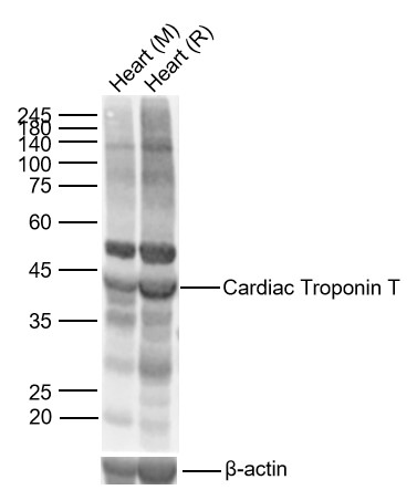 Lane 1: Mouse Heart Lysates; Lane 2: Rat Heart Lysates. Probed with Cardiac Troponin T polyclonal Antibody, unconjugated (bs-10648R) at 1:1000 dilution and 4°C overnight incubation. Followed by conjugated secondary antibody incubation at 1:20000 for 60 min at 37˚C.