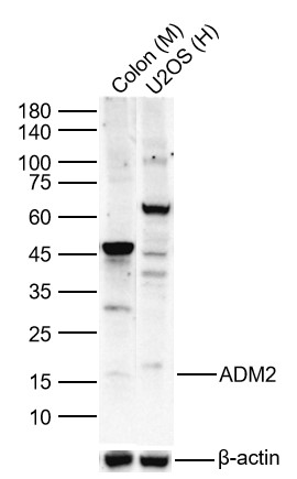 Lane 1: Mouse Colon Lysates; Lane 2: Human U-2 OS cell Lysates. Probed with ADM2 polyclonal Antibody, unconjugated (bs-2985R) at 1:1000 dilution and 4\u00b0C overnight incubation. Followed by conjugated secondary antibody incubation at 1:20000 for 60 min at 37˚C.