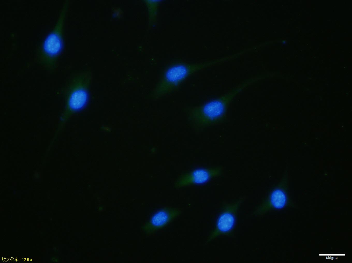 SHSY5Y cell; 4% Paraformaldehyde-fixed; Triton X-100 at room temperature for 20 min; Blocking buffer (normal goat serum, C-0005) at 37°C for 20 min; Antibody incubation with (phospho-GATA3 (Ser162)) polyclonal Antibody, Unconjugated (bs-10280R) 1:100, 90 minutes at 37°C; followed by a conjugated Goat Anti-Rabbit IgG antibody at 37°C for 90 minutes, DAPI (blue, C02-04002) was used to stain the cell nuclei.