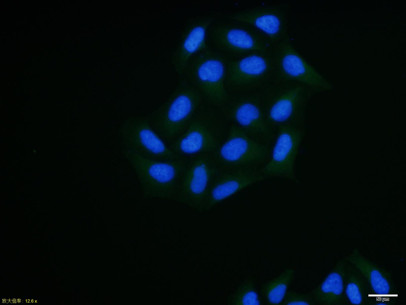 Hela cell; 4% Paraformaldehyde-fixed; Triton X-100 at room temperature for 20 min; Blocking buffer (normal goat serum, C-0005) at 37°C for 20 min; Antibody incubation with (Thioredoxin) polyclonal Antibody, Unconjugated (bs-0458R) 1:100, 90 minutes at 37°C; followed by a conjugated Goat Anti-Rabbit IgG antibody at 37°C for 90 minutes, DAPI (blue, C02-04002) was used to stain the cell nuclei.