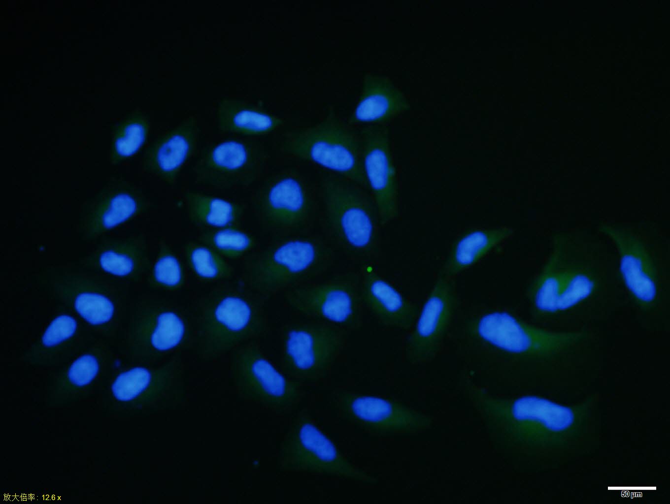 Hela cell; 4% Paraformaldehyde-fixed; Triton X-100 at room temperature for 20 min; Blocking buffer (normal goat serum, C-0005) at 37°C for 20 min; Antibody incubation with (PPP4C) polyclonal Antibody, Unconjugated (bs-0490R) 1:100, 90 minutes at 37°C; followed by a conjugated Goat Anti-Rabbit IgG antibody at 37°C for 90 minutes, DAPI (blue, C02-04002) was used to stain the cell nuclei.