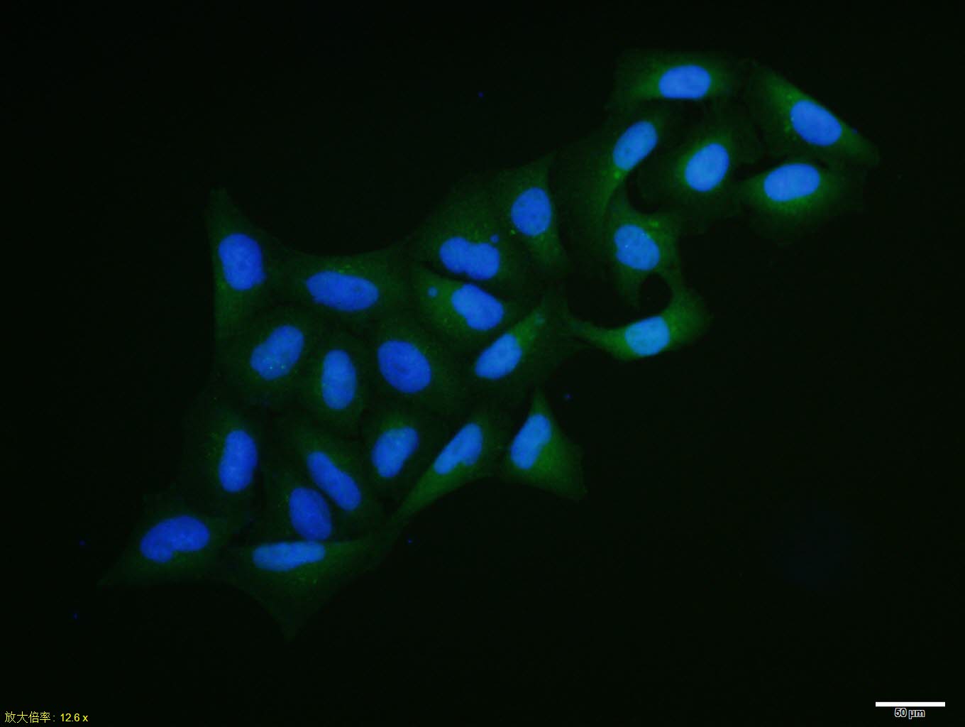 Hela cell; 4% Paraformaldehyde-fixed; Triton X-100 at room temperature for 20 min; Blocking buffer (normal goat serum, C-0005) at 37°C for 20 min; Antibody incubation with (PALB2) polyclonal Antibody, Unconjugated (bs-0588R) 1:100, 90 minutes at 37°C; followed by a conjugated Goat Anti-Rabbit IgG antibody at 37°C for 90 minutes, DAPI (blue, C02-04002) was used to stain the cell nuclei.