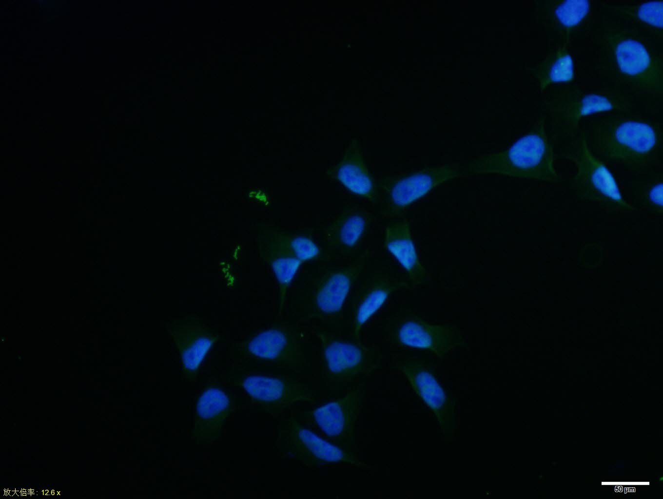 Hela cell; 4% Paraformaldehyde-fixed; Triton X-100 at room temperature for 20 min; Blocking buffer (normal goat serum, C-0005) at 37°C for 20 min; Antibody incubation with (Cyclin D3) polyclonal Antibody, Unconjugated (bs-0660R) 1:100, 90 minutes at 37°C; followed by a conjugated Goat Anti-Rabbit IgG antibody at 37°C for 90 minutes, DAPI (blue, C02-04002) was used to stain the cell nuclei.