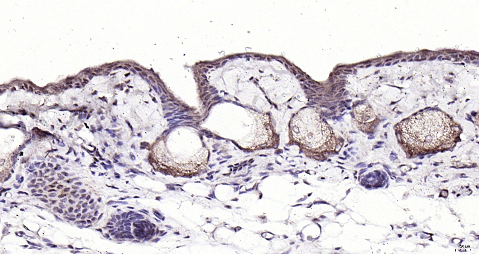 Paraformaldehyde-fixed, paraffin embedded (rat skin); Antigen retrieval by boiling in sodium citrate buffer (pH6.0) for 15min; Block endogenous peroxidase by 3% hydrogen peroxide for 20 minutes; Blocking buffer (normal goat serum) at 37°C for 30min; Antibody incubation with (CRABP2) Polyclonal Antibody, Unconjugated (bs-6038R) at 1:200 overnight at 4°C, followed by operating according to SP Kit(Rabbit) (sp-0023) instructionsand DAB staining.