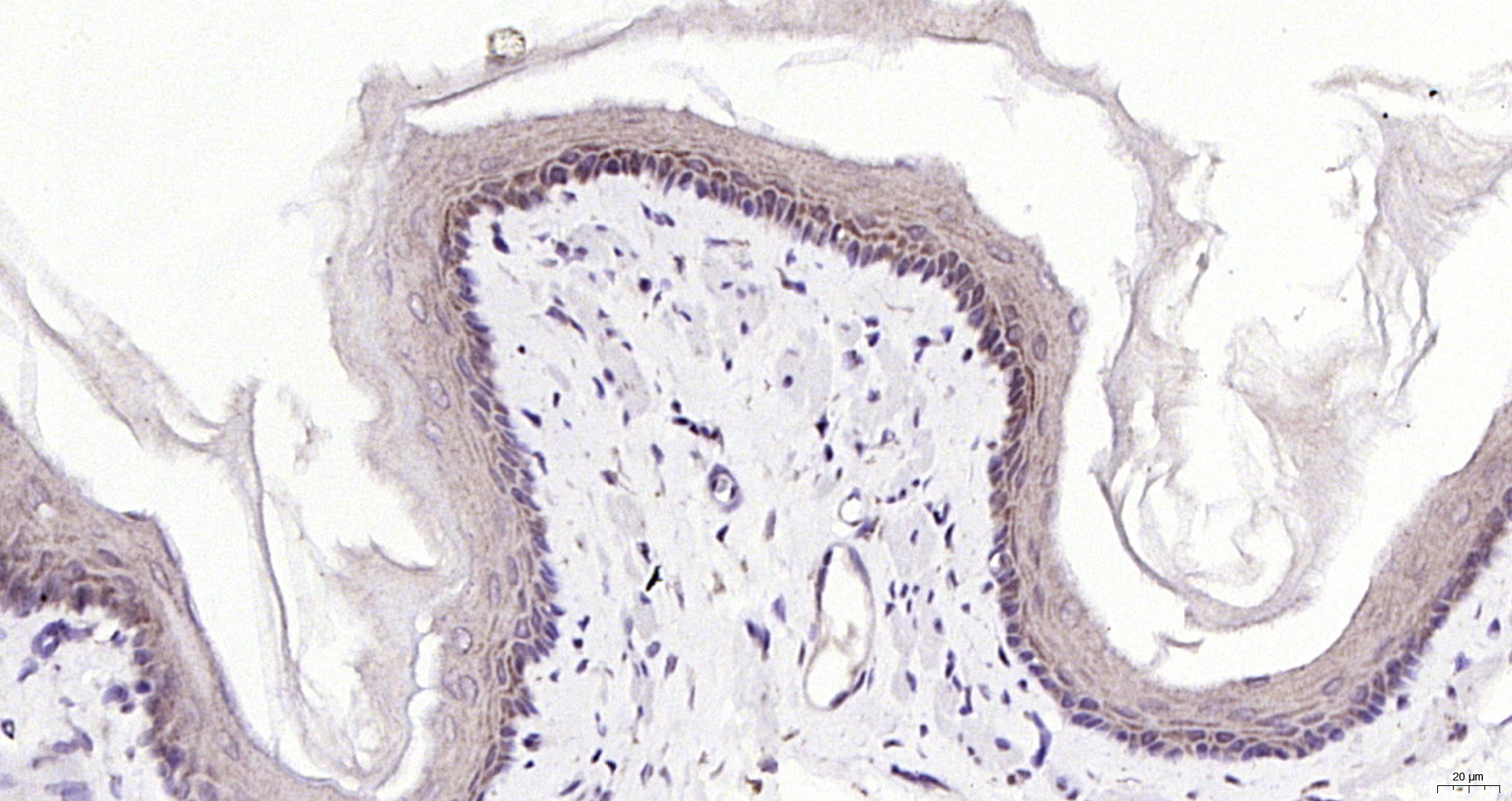 Paraformaldehyde-fixed, paraffin embedded (rat esophagus); Antigen retrieval by boiling in sodium citrate buffer (pH6.0) for 15min; Block endogenous peroxidase by 3% hydrogen peroxide for 20 minutes; Blocking buffer (normal goat serum) at 37°C for 30min; Antibody incubation with (CRABP2) Polyclonal Antibody, Unconjugated (bs-6038R) at 1:200 overnight at 4°C, followed by operating according to SP Kit(Rabbit) (sp-0023) instructionsand DAB staining.