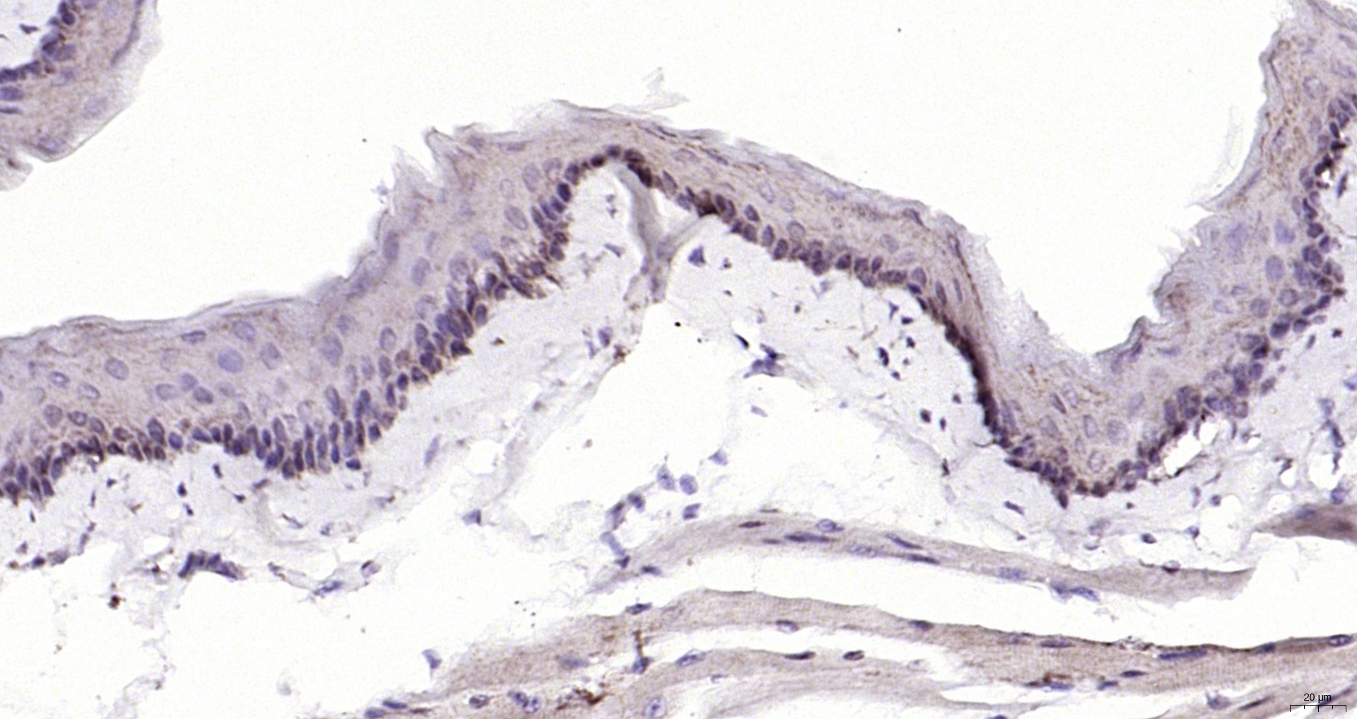 Paraformaldehyde-fixed, paraffin embedded (mouse esophagus); Antigen retrieval by boiling in sodium citrate buffer (pH6.0) for 15min; Block endogenous peroxidase by 3% hydrogen peroxide for 20 minutes; Blocking buffer (normal goat serum) at 37°C for 30min; Antibody incubation with (CRABP2) Polyclonal Antibody, Unconjugated (bs-6038R) at 1:200 overnight at 4°C, followed by operating according to SP Kit(Rabbit) (sp-0023) instructionsand DAB staining.