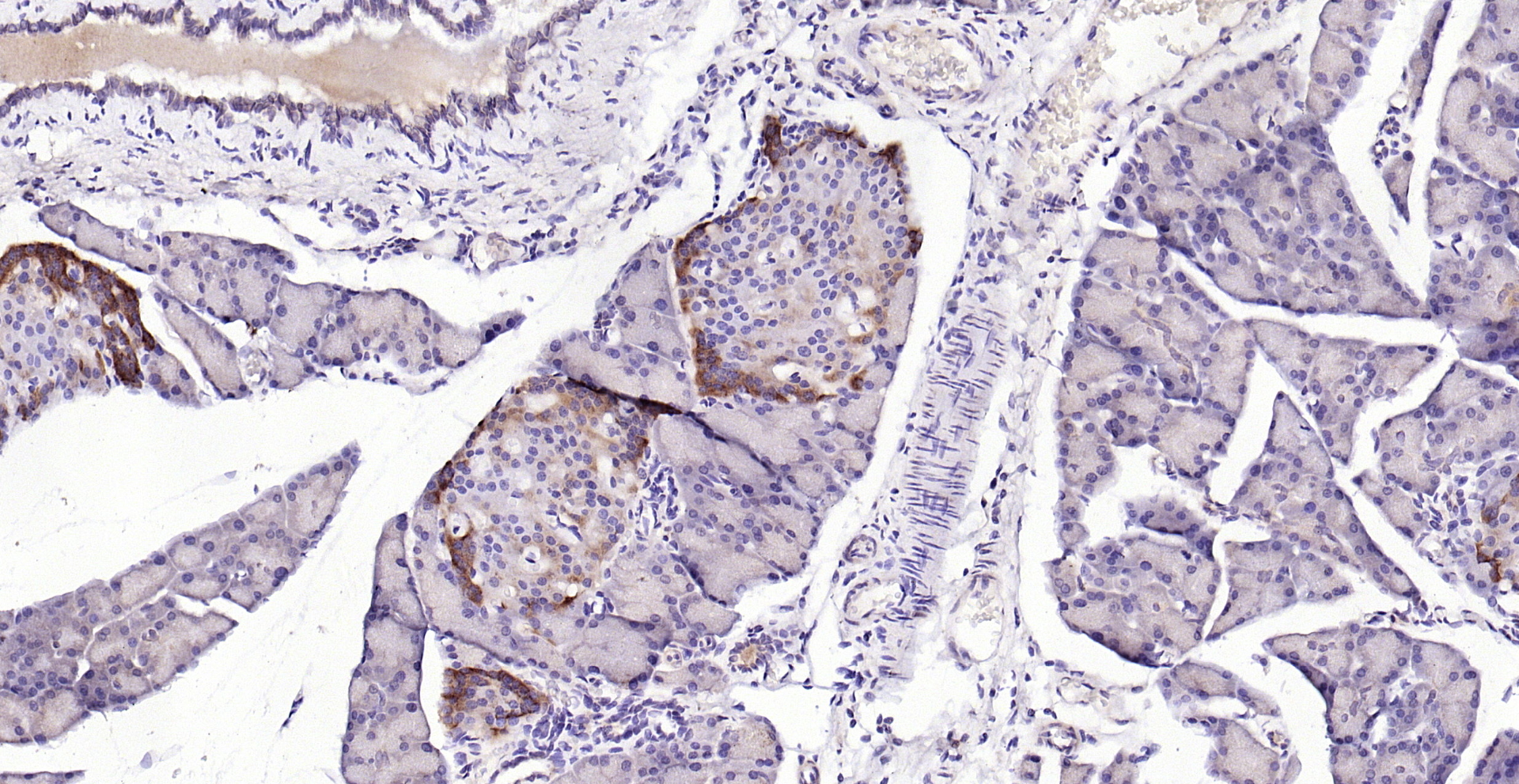 Paraformaldehyde-fixed, paraffin embedded (mouse pancreas); Antigen retrieval by boiling in sodium citrate buffer (pH6.0) for 15min; Block endogenous peroxidase by 3% hydrogen peroxide for 20 minutes; Blocking buffer (normal goat serum) at 37°C for 30min; Antibody incubation with (KLHL22) Polyclonal Antibody, Unconjugated (bs-7807R) at 1:200 overnight at 4°C, followed by operating according to SP Kit(Rabbit) (sp-0023) instructionsand DAB staining.