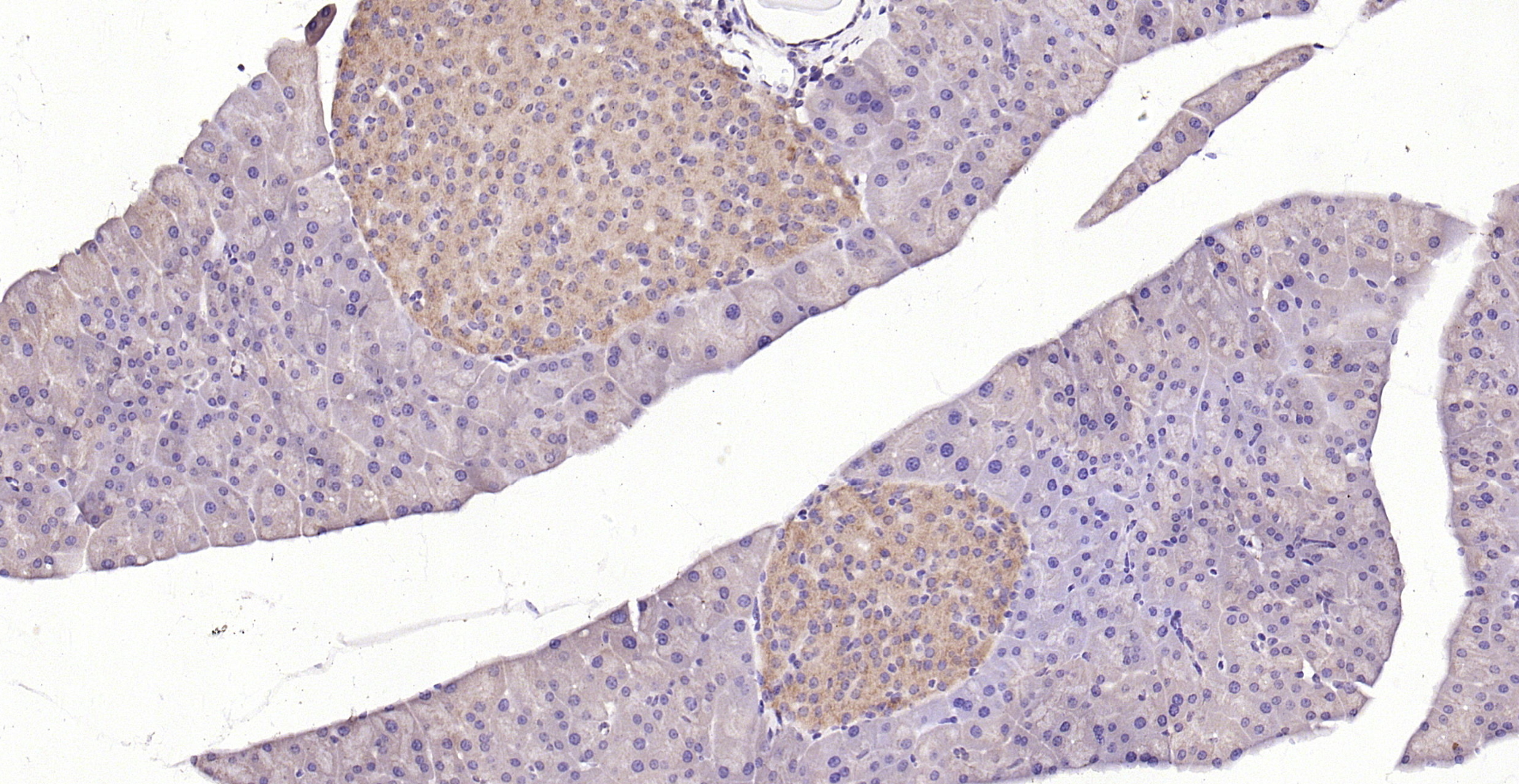 Paraformaldehyde-fixed, paraffin embedded (rat pancreas); Antigen retrieval by boiling in sodium citrate buffer (pH6.0) for 15min; Block endogenous peroxidase by 3% hydrogen peroxide for 20 minutes; Blocking buffer (normal goat serum) at 37°C for 30min; Antibody incubation with (KLHL22) Polyclonal Antibody, Unconjugated (bs-7807R) at 1:200 overnight at 4°C, followed by operating according to SP Kit(Rabbit) (sp-0023) instructionsand DAB staining.