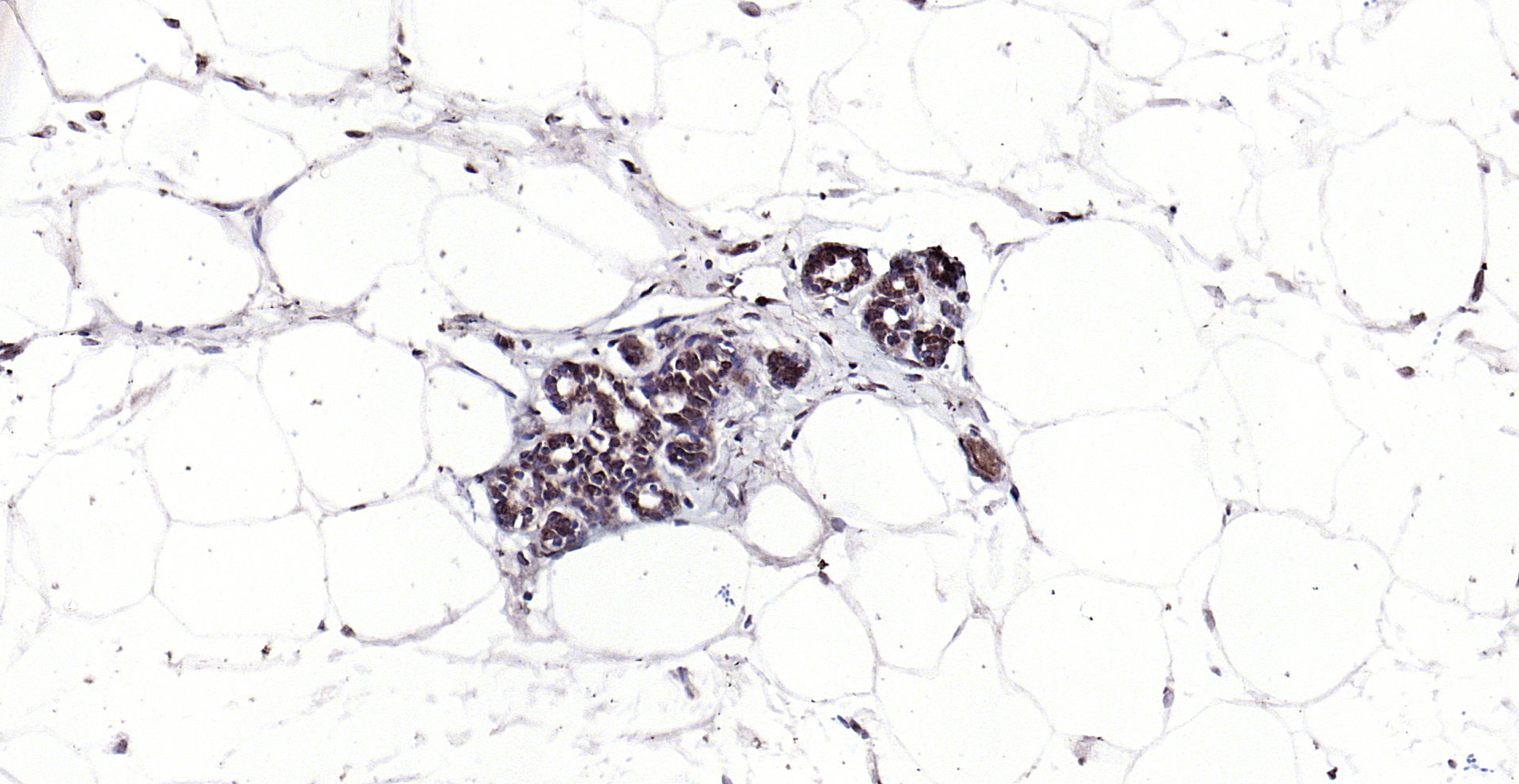 Paraformaldehyde-fixed, paraffin embedded (rat breast); Antigen retrieval by boiling in sodium citrate buffer (pH6.0) for 15min; Block endogenous peroxidase by 3% hydrogen peroxide for 20 minutes; Blocking buffer (normal goat serum) at 37°C for 30min; Antibody incubation with (SPDEF) Polyclonal Antibody, Unconjugated (bs-1866R) at 1:200 overnight at 4°C, followed by operating according to SP Kit(Rabbit) (sp-0023) instructionsand DAB staining.