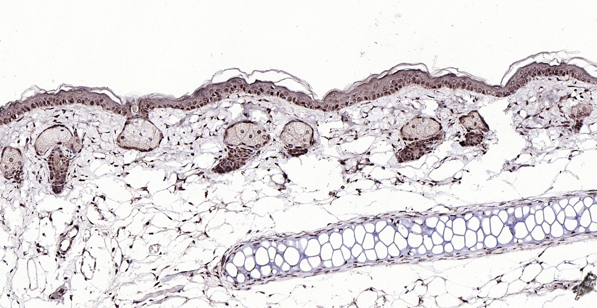 Paraformaldehyde-fixed, paraffin embedded (mouse skin); Antigen retrieval by boiling in sodium citrate buffer (pH6.0) for 15min; Block endogenous peroxidase by 3% hydrogen peroxide for 20 minutes; Blocking buffer (normal goat serum) at 37°C for 30min; Antibody incubation with (SPDEF) Polyclonal Antibody, Unconjugated (bs-1866R) at 1:200 overnight at 4°C, followed by operating according to SP Kit(Rabbit) (sp-0023) instructionsand DAB staining.
