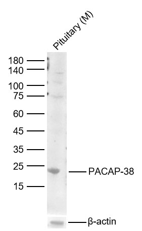Lane 1: Mouse Pituitary Lysates. Probed with PACAP-38 polyclonal Antibody, unconjugated (bs-0200R) at 1:1000 dilution and 4°C overnight incubation. Followed by conjugated secondary antibody incubation at 1:20000 for 60 min at 37˚C.