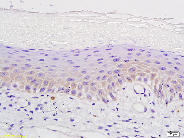 Formalin-fixed and paraffin embedded mouse skin labeled with Anti-µ-Opioid receptor Polyclonal Antibody, Unconjugated (bs-3623R) followed by conjugation to the secondary antibody and DAB staining