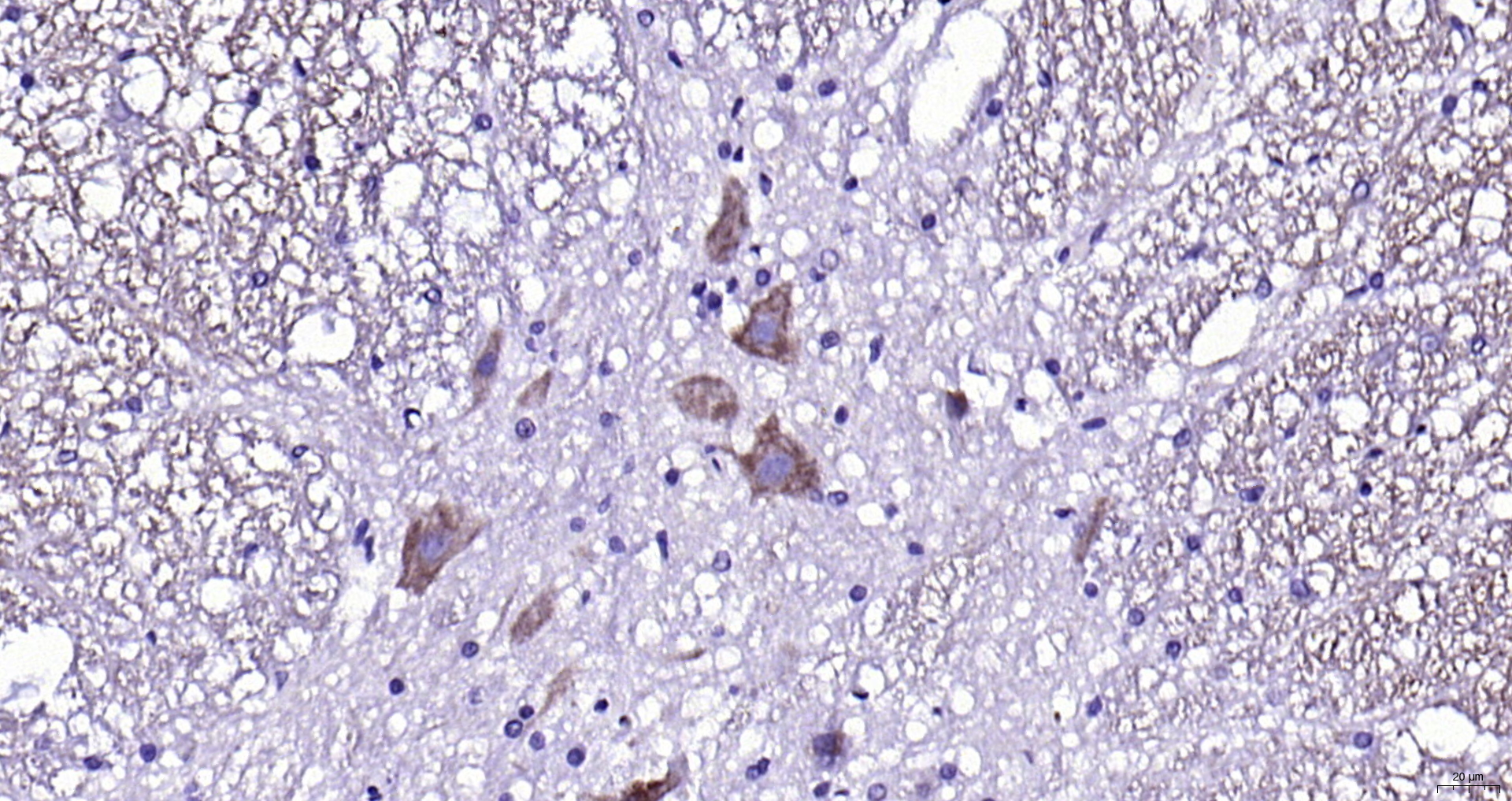 Paraformaldehyde-fixed, paraffin embedded (rat spinal cord); Antigen retrieval by boiling in sodium citrate buffer (pH6.0) for 15min; Block endogenous peroxidase by 3% hydrogen peroxide for 20 minutes; Blocking buffer (normal goat serum) at 37°C for 30min; Antibody incubation with (CX3CR1) Polyclonal Antibody, Unconjugated (bs-1728R) at 1:1000 overnight at 4°C, followed by operating according to SP Kit(Rabbit) (sp-0023) instructionsand DAB staining.