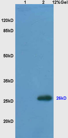 L1 mouse embryo lysates, L2 mouse brain lysates probed with Anti- Bcl-2 Polyclonal Antibody, Unconjugated (bs-0032R) at 1:200 in 4˚C. Followed by conjugation to secondary antibody (bs-0295G-HRP) at 1:3000 90min in 37˚C. P