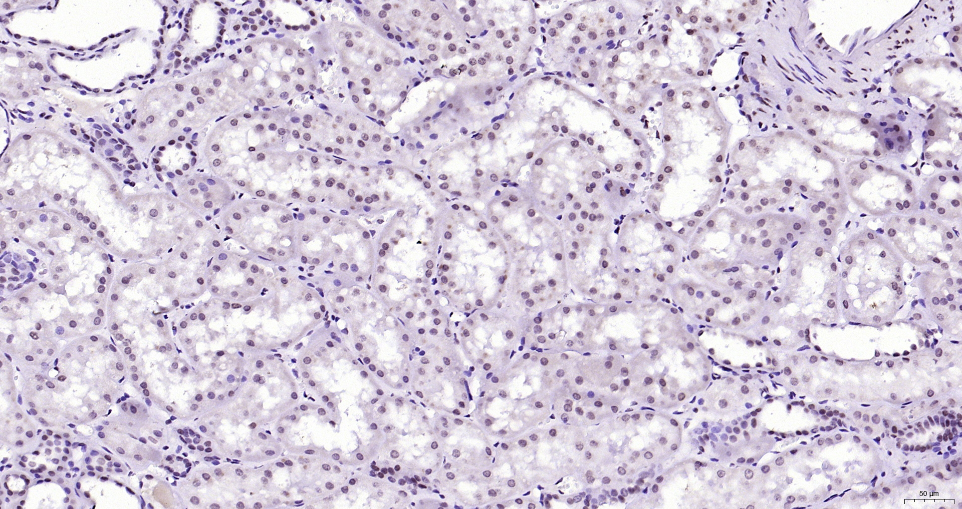 Paraformaldehyde-fixed, paraffin embedded (human kidney); Antigen retrieval by boiling in sodium citrate buffer (pH6.0) for 15min; Block endogenous peroxidase by 3% hydrogen peroxide for 20 minutes; Blocking buffer (normal goat serum) at 37°C for 30min; Antibody incubation with (Phospho-FGFR1 (Tyr307)) Polyclonal Antibody, Unconjugated (bs-5325R) at 1:200 overnight at 4°C, followed by operating according to SP Kit(Rabbit) (sp-0023) instructionsand DAB staining.