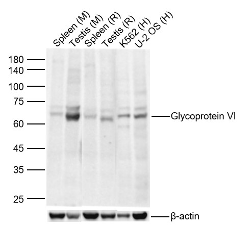 Lane 1: Mouse Spleen Lysates; Lane 2: Mouse Testis Lysates; Lane 3: Rat Spleen Lysates; Lane 4: Rat Testis Lysates; Lane 5: Human K562 cell Lysates; Lane 6: Human U-2 OS cell Lysates. Probed with Glycoprotein VI polyclonal Antibody, unconjugated (bs-9897R) at 1:1000 dilution and 4°C overnight incubation. Followed by conjugated secondary antibody incubation at 1:20000 for 60 min at 37˚C.
