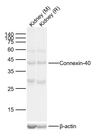 Lane 1: Mouse Kidney Lysates; Lane 2: Rat Kidney Lysates. Probed with Connexin-40 polyclonal Antibody, unconjugated (bs-1050R) at 1:1000 dilution and 4°C overnight incubation. Followed by conjugated secondary antibody incubation at 1:20000 for 60 min at 37˚C.