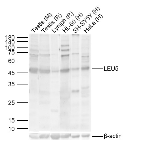 Lane 1: Mouse Testis Lysates; Lane 2: Rat Testis Lysates; Lane 3: Rat Lymph Lysates; Lane 4: Human HL-60 cell Lysates; Lane 5: Human SH-SY5Y cell Lysates; Lane 6: Human HeLa cell Lysates. Probed with LEU5 polyclonal Antibody, unconjugated (bs-6395R) at 1:1000 dilution and 4°C overnight incubation. Followed by conjugated secondary antibody incubation at 1:20000 for 60 min at 37˚C.