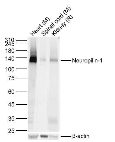 Lane 1: Mouse Heart Lysates; Lane 2: Mouse Spinal cord Lysates; Lane 3: Rat Kidney Lysates. Probed with Neuropilin-1 monoclonal Antibody, unconjugated (bsm-52479R) at 1:1000 dilution and 4°C overnight incubation. Followed by conjugated secondary antibody incubation at 1:20000 for 60 min at 37˚C.