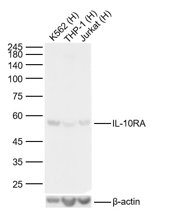 Lane 1: Human K562 cell Lysates; Lane 2: Human THP-1 cell Lysates; Lane 3: Human Jurkat cell Lysates. Probed with IL-10RA polyclonal Antibody, unconjugated (bs-2459R) at 1:1000 dilution and 4°C overnight incubation. Followed by conjugated secondary antibody incubation at 1:20000 for 60 min at 37˚C.