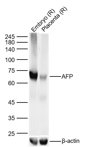 Lane 1: Rat Embryo Lysates; Lane 2: Rat Placenta Lysates. Probed with AFP(A2) monoclonal Antibody, unconjugated (bsm-1621M) at 1:1000 dilution and 4\u00b0C overnight incubation. Followed by conjugated secondary antibody incubation at 1:20000 for 60 min at 37˚C.