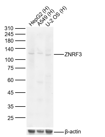 Lane 1: Human HepG2 cell Lysates; Lane 2: Human A549 cell Lysates; Lane 3: Human U-2 OS cell Lysates. Probed with ZNRF3 polyclonal Antibody, unconjugated (bs-9141R) at 1:1000 dilution and 4°C overnight incubation. Followed by conjugated secondary antibody incubation at 1:20000 for 60 min at 37˚C.