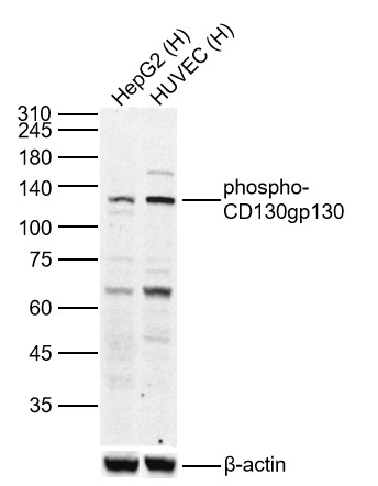 Lane 1: Human HepG2 cell Lysates; Lane 2: Human HUVEC cell Lysates. Probed with phospho-CD130gp130 (Ser782) polyclonal Antibody, unconjugated (bs-10122R) at 1:1000 dilution and 4°C overnight incubation. Followed by conjugated secondary antibody incubation at 1:20000 for 60 min at 37˚C.