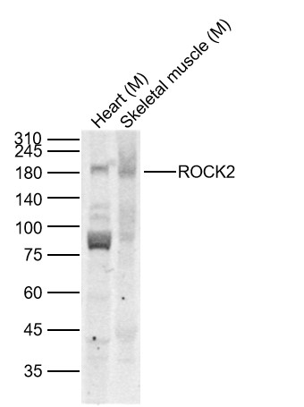 Lane 1: Mouse Heart Lysates; Lane 2: Mouse Skeletal muscle Lysates. Probed with ROCK2 polyclonal Antibody, unconjugated (bs-1205R) at 1:1000 dilution and 4\u00b0C overnight incubation. Followed by conjugated secondary antibody incubation at 1:20000 for 60 min at 37˚C.