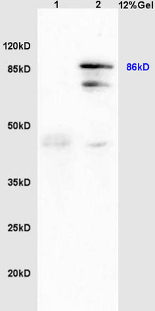 L1 human colon carcinoma lysates, L2 mouse liver lysates probed with Anti GRP94/HSP GP96 Polyclonal Antibody, Unconjugated (bs-0194R) at 1:200 in 4˚C. Followed by conjugation to secondary antibody (bs-0295G-HRP) at 1:3000 90min in 37˚C. Predicted band and observed band size: 86kD