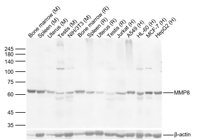 Lane 1: Mouse Bone marrow Lysates; Lane 2: Mouse Spleen Lysates; Lane 3: Mouse Uterus Lysates; Lane 4: Mouse Testis Lysates; Lane 5: Mouse NIH/3T3 cell Lysates; Lane 6: Rat Bone marrow Lysates; Lane 7: Rat Spleen Lysates; Lane 8: Rat Uterus Lysates; Lane 9: Rat Testis Lysates; Lane 10: Human Jurkat cell Lysates; Lane 11: Human A549 cell Lysates; Lane 12: Human HL-60 cell Lysates; Lane 13: Human MCF-7 cell Lysates; Lane 14: Human HepG2 cell Lysates. Probed with MMP8 polyclonal Antibody, unconjugated (bs-1913R) at 1:1000 dilution and 4°C overnight incubation. Followed by conjugated secondary antibody incubation at 1:20000 for 60 min at 37˚C.
